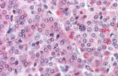 Immunohistochemistry-Paraffin MLEC Antibody - BSA Free